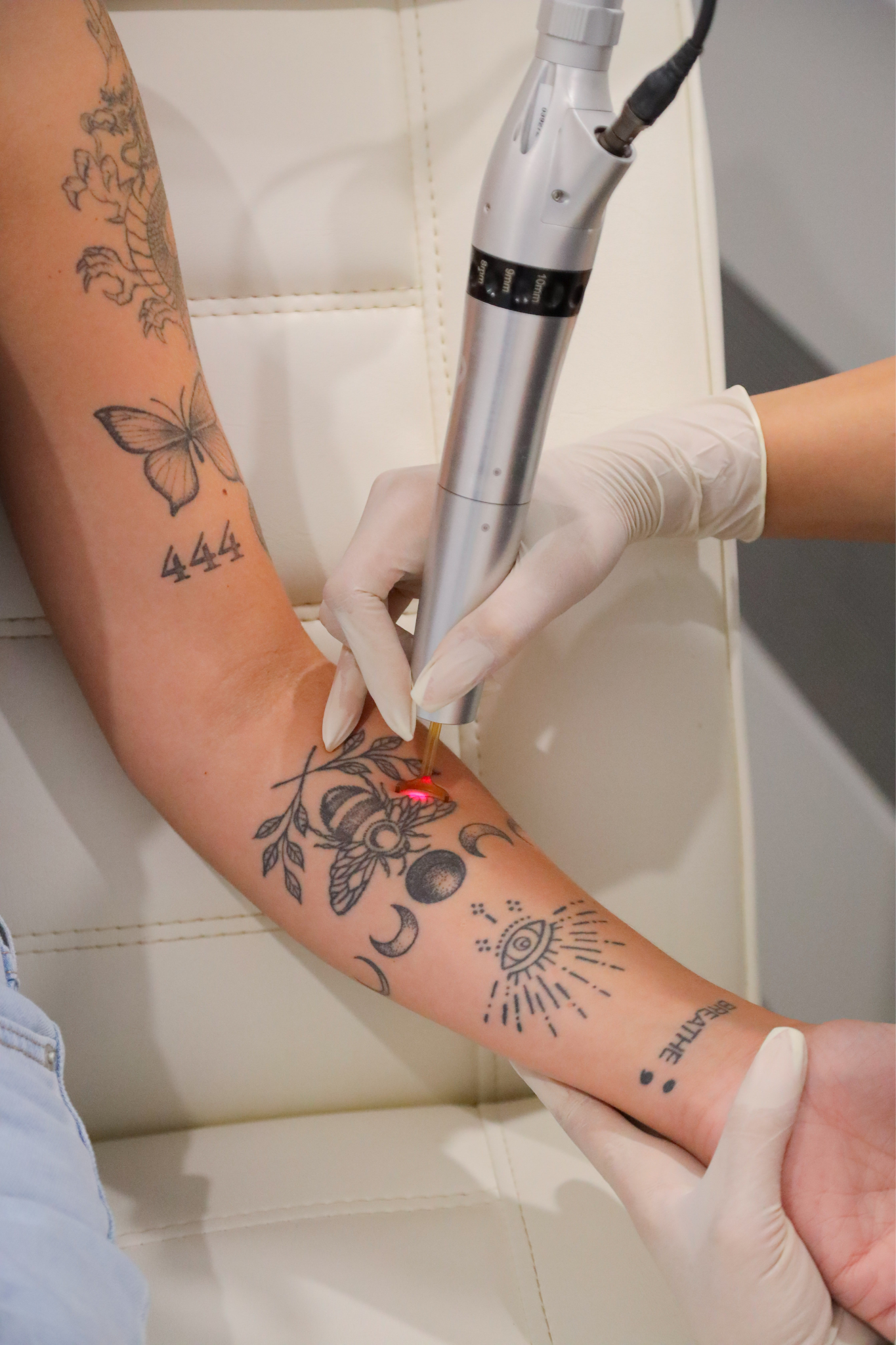 Laser Tattoo Removal Perth | Tattoo Removal Perth | Skin Resus